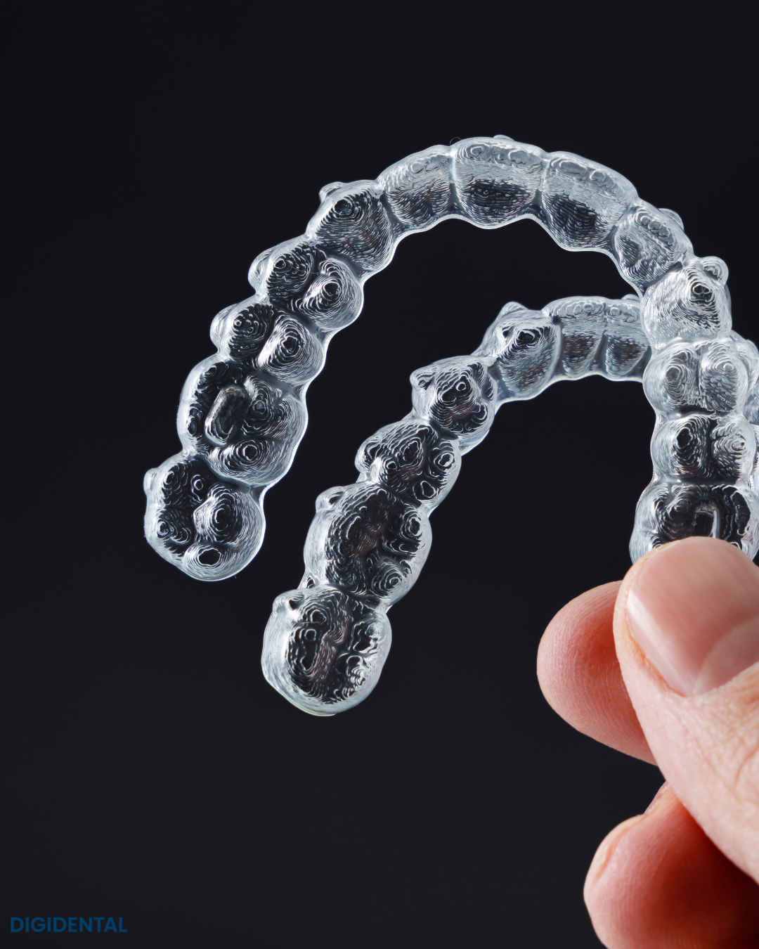 Contentions transparentes et appareils orthodontiques sur mesure fabriqués au laboratoire dentaire numérique Digidental à Laval